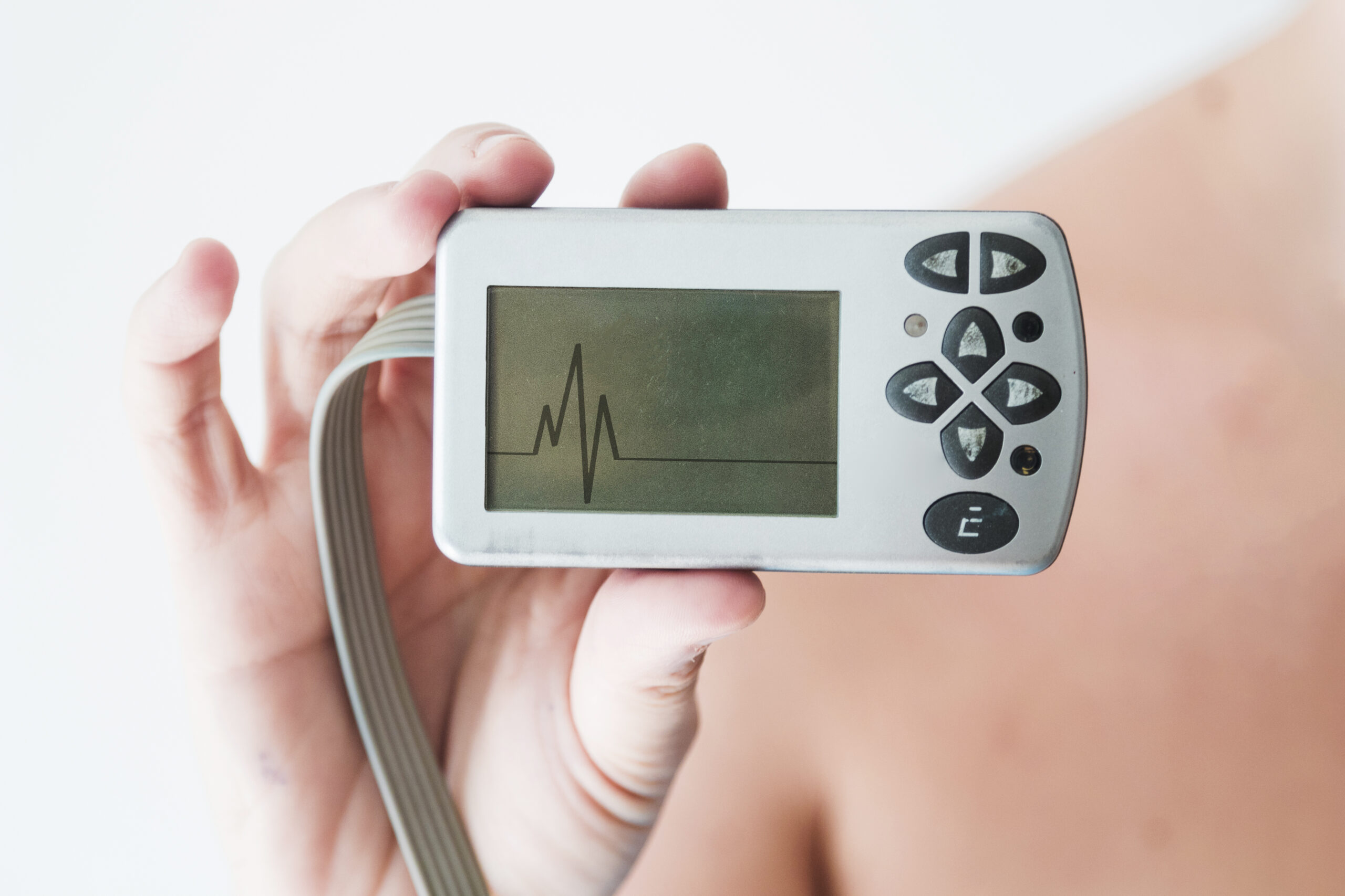 Aparelho de Holter 24 horas exibindo o traçado do ritmo cardíaco